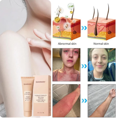 Gel Exfoliante Quarxery Original