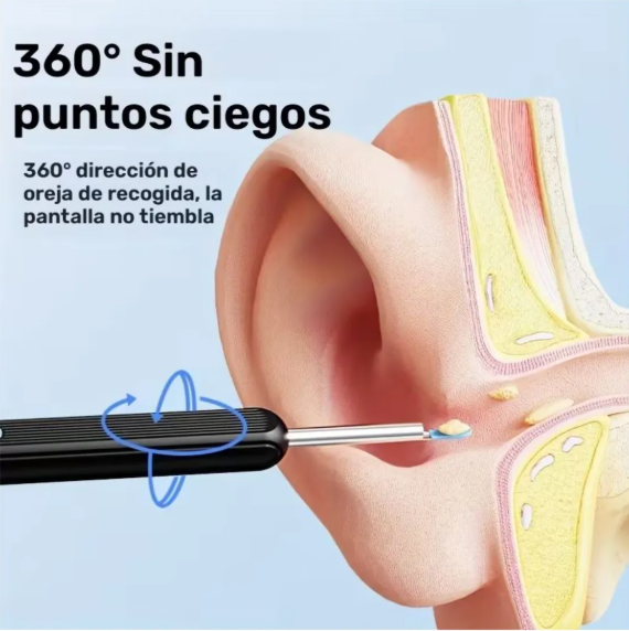 Limpiador de Oidos NE3